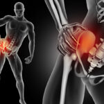 hip pain
