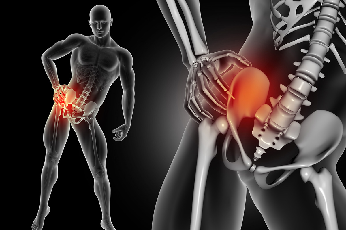 hip pain